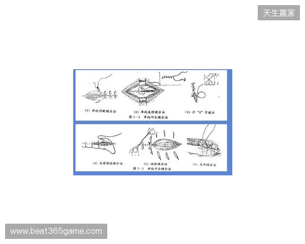 广州豹官方:杨浩眉弓伤口缝合30余针,预计5-7天后拆线 广州豹官方:杨浩眉弓伤口缝合30余针,预计5-7天后拆线